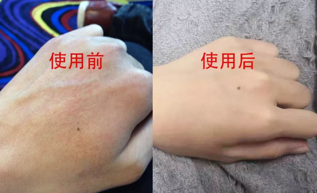 手纹深粗糙是不是比较好,手纹深粗糙干燥怎么办