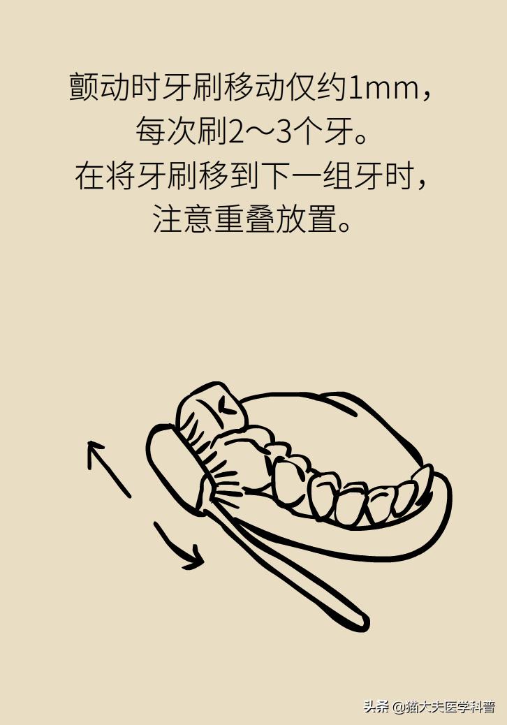 牙龈肿痛牙龈出血是啥原因引起的,牙龈肿痛出血是胃火大引发的吗