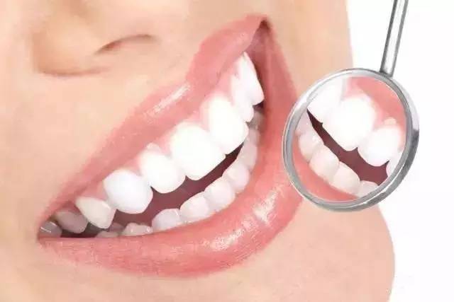 牙齿黑三角要及时修复吗,牙齿黑三角自愈图片