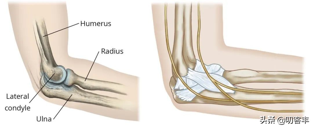 小孩肘关节骨折怎么做康复,儿童肘部骨折怎么办