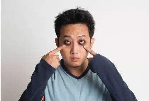 黑眼圈非常严重用什么方法去除,黑眼圈严重怎么办才能彻底去除