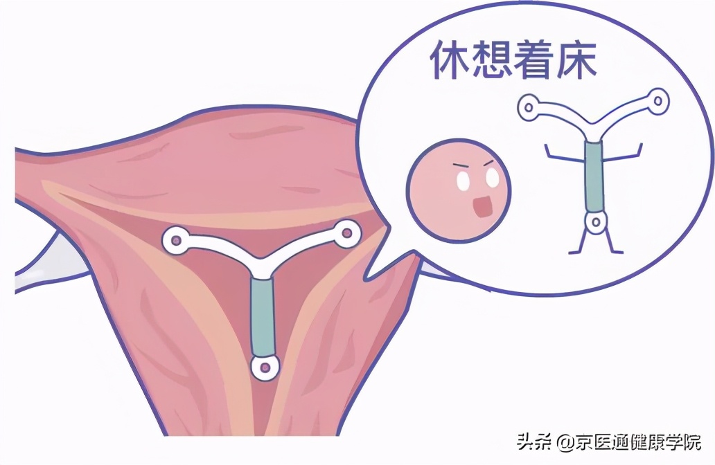 古代避孕最有效的方法,中医紧急避孕补救法大全