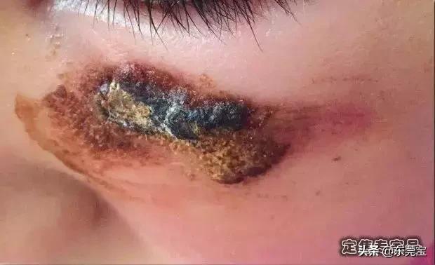 把芦荟胶当万能药,抹芦荟胶有多大的伤害