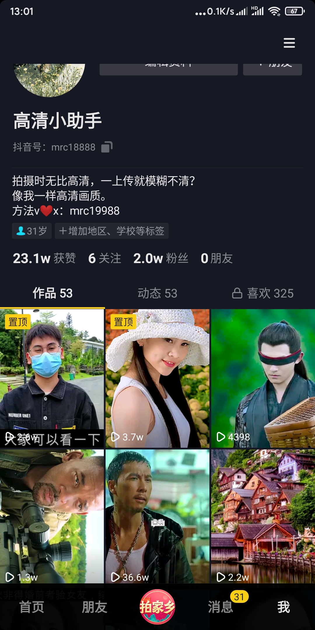 抖音怎么上传高清视频？干货，从此告别模糊