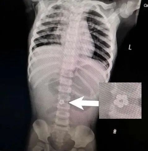 千万不要给孩子玩网红玩具,家长必须记住孩子玩的危险玩具