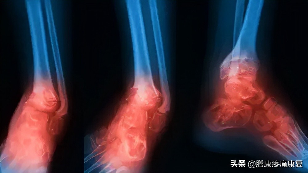 老人小腿疼痛是什么原因,小腿疼痛是什么原因引起的