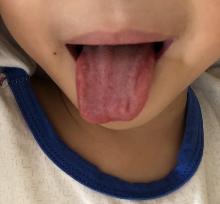 宝宝生病老是反反复复怎么回事,宝宝生病老是要睡觉怎么办