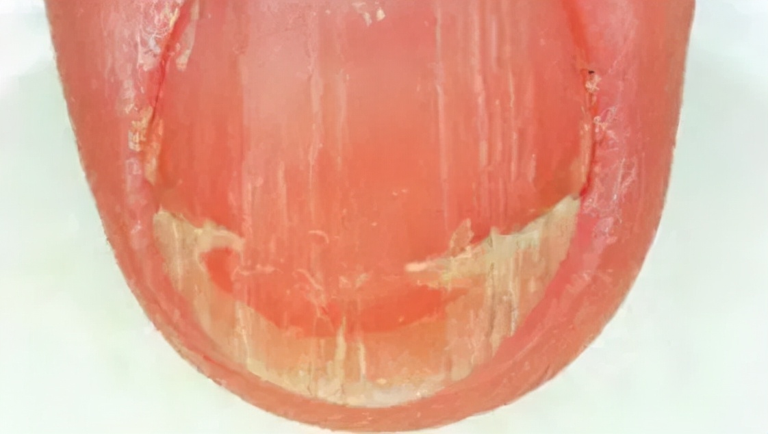 想让指甲长得快些怎么办,想让指甲变好看怎么办