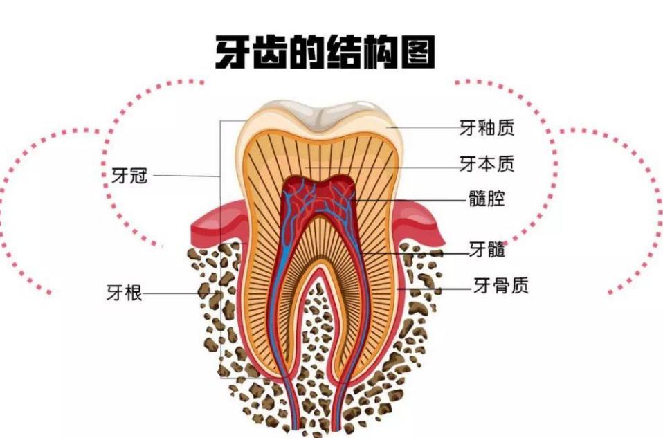 蛀牙是怎么形成的真的有虫吗,蛀牙真的是因为虫子吗