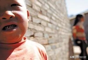 一口黄牙有多尴尬,一口烂牙怎么补救