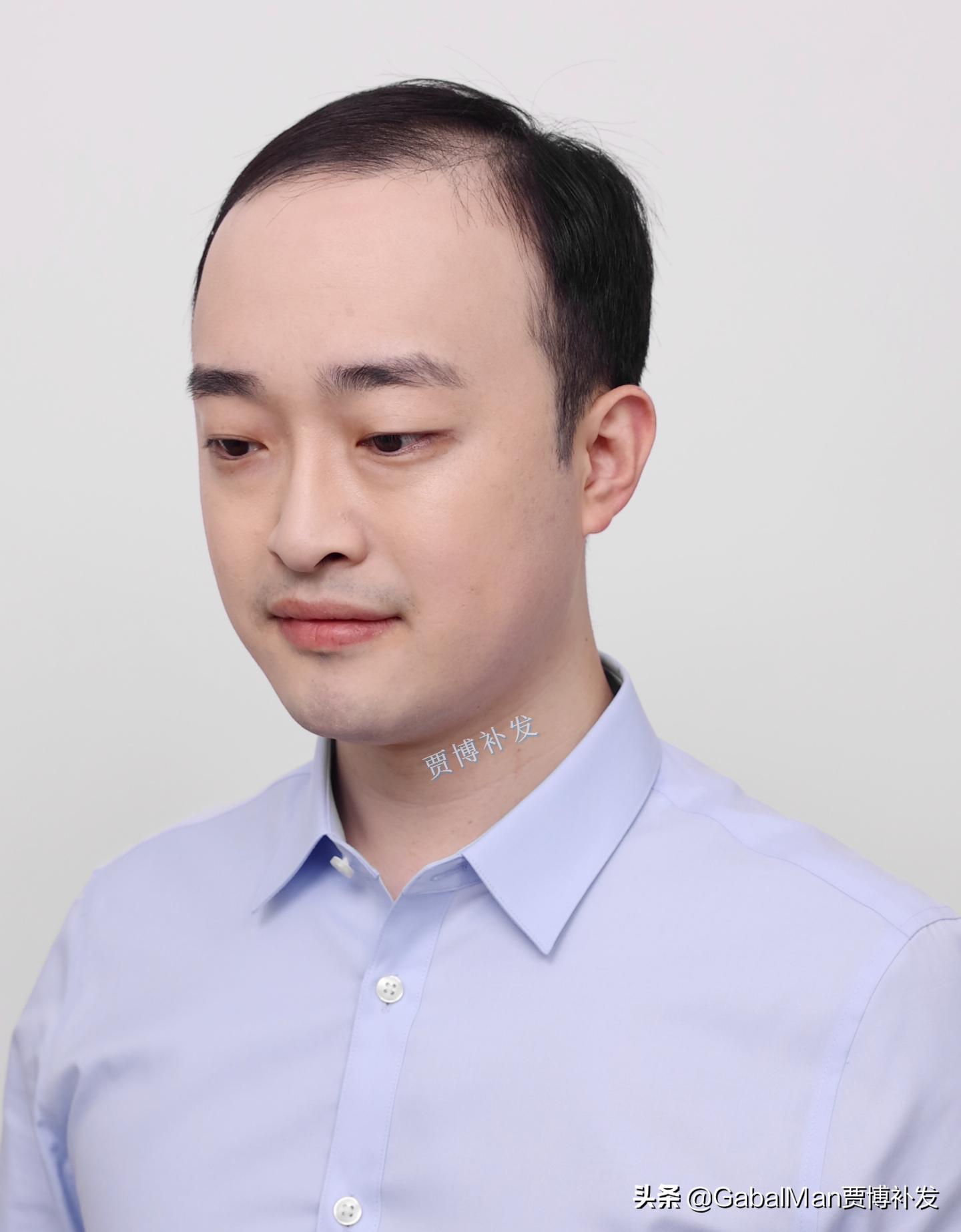 不怕风吹雨淋的假发,不怕风的假发