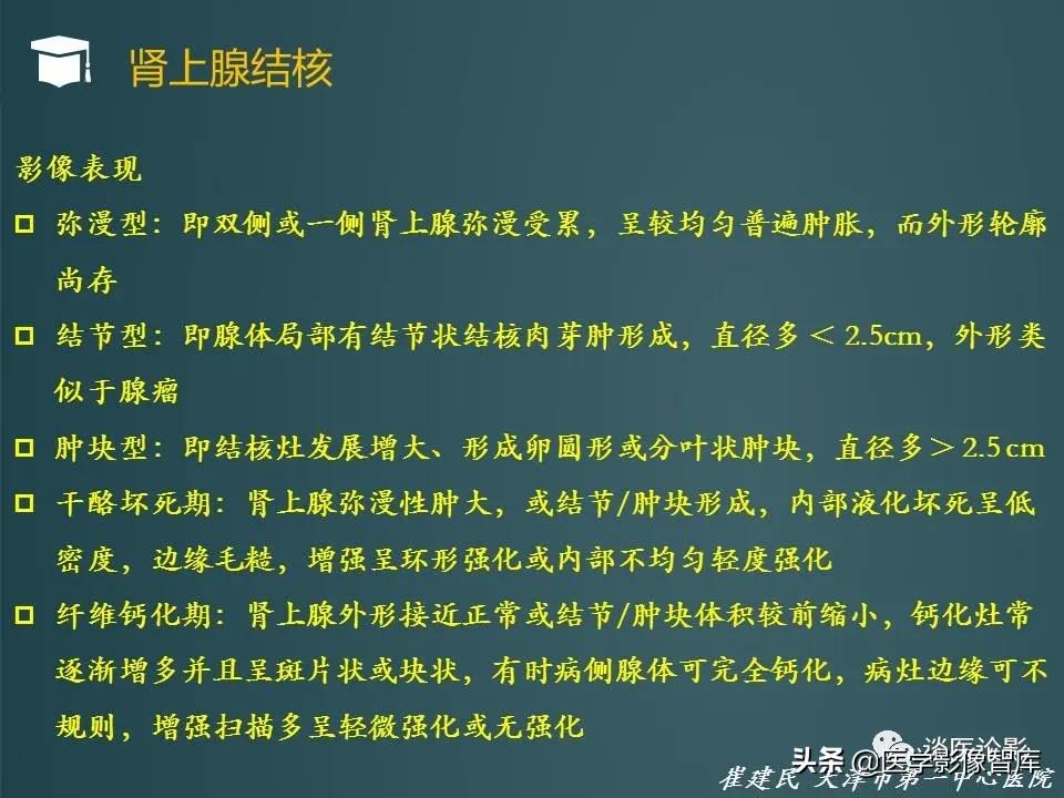 左侧肾上腺结节考虑腺瘤与增生,双侧肾上腺增生是什么原因造成的