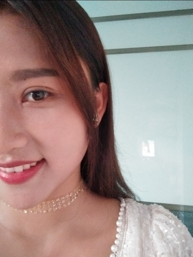 韩美做双眼皮,南昌韩美医院做双眼皮怎么样