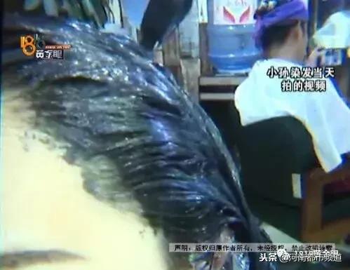杭州漂亮女孩扎马尾头皮一下秃了四块！她怀疑那次在理发店……