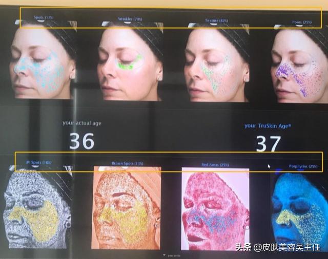 visia皮肤检测分高低吗,visia皮肤检测值多少是正常的