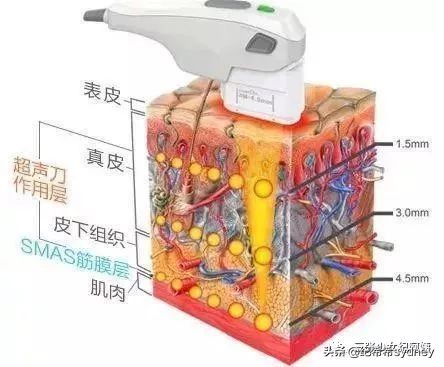 卡戴珊詹娜医美,卡戴珊太后医美