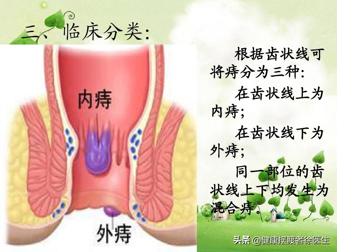 解便时发现有血怎么回事,解便时带有鲜血是怎么回事