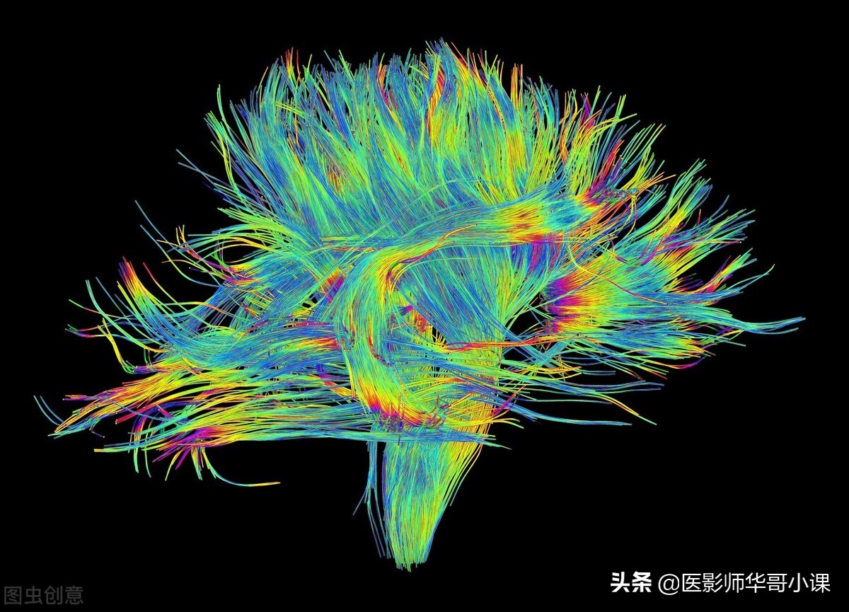 飞利浦磁共振波谱成像扫描技术,飞利浦磁共振纵隔扫描技术
