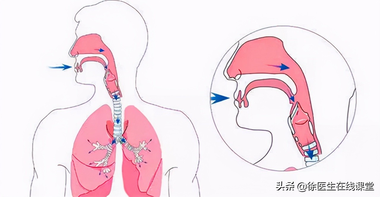 肺脓肿是局限性化脓性炎吗,急性肺脓肿与其他疾病鉴别