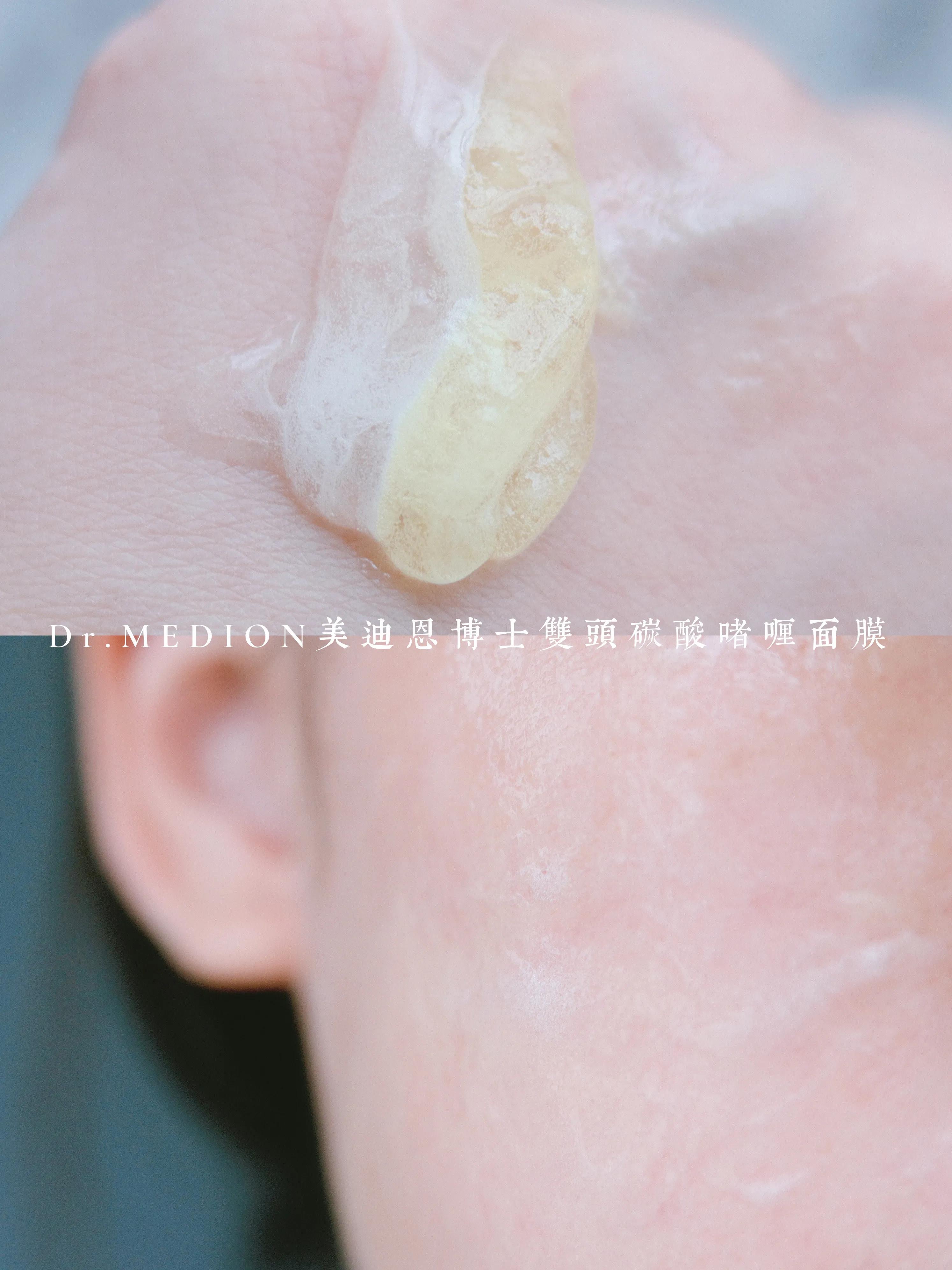 敷完面膜后的我,碳酸型面膜真的好用吗