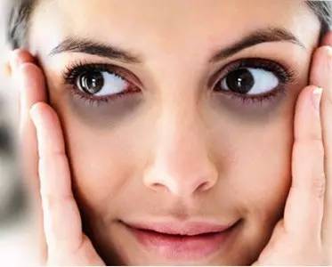 眼袋黑眼圈严重怎么治疗,眼袋黑眼圈怎么治