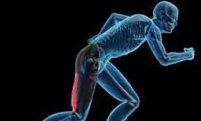 腿筋拉伤是不是腘绳肌拉伤,大腿内侧筋拉伤怎么处理