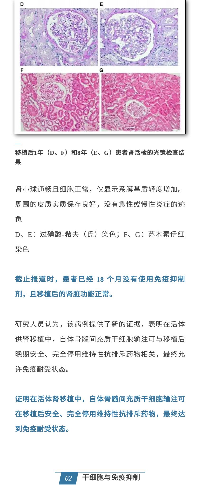 干细胞移植肾细胞再生疗法,干细胞肾脏移植最新进展