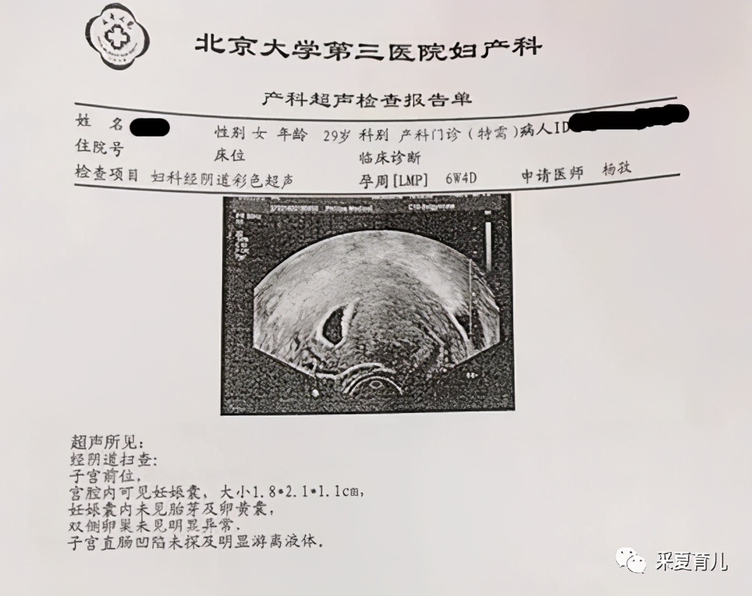 7周未见卵黄囊未见胎芽胎心,未见胎心胎芽搏动是什么意思