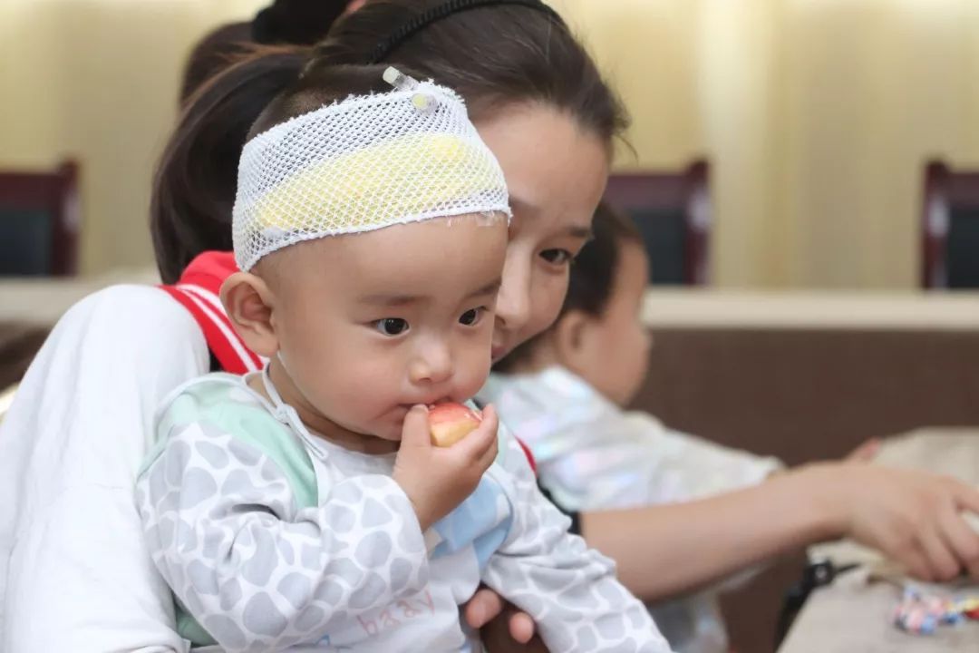 小儿发热该怎么治,小儿发热处理方法中医