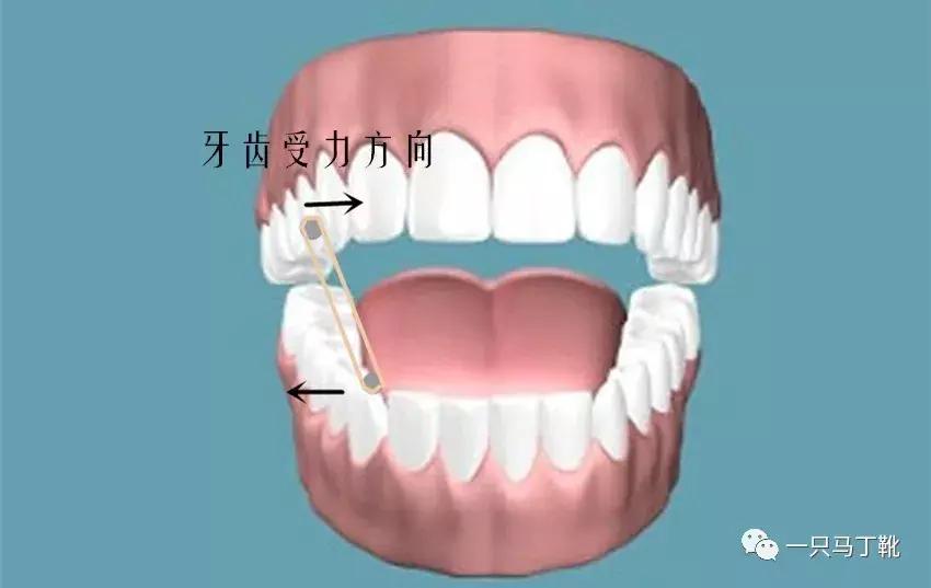 整牙给你点靠谱的建议,整牙亲身经历经验分享