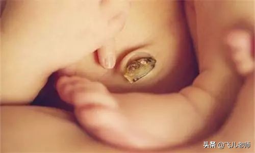 新生儿脐带一个月了还不掉怎么办,新生儿脐带一个多月未脱落