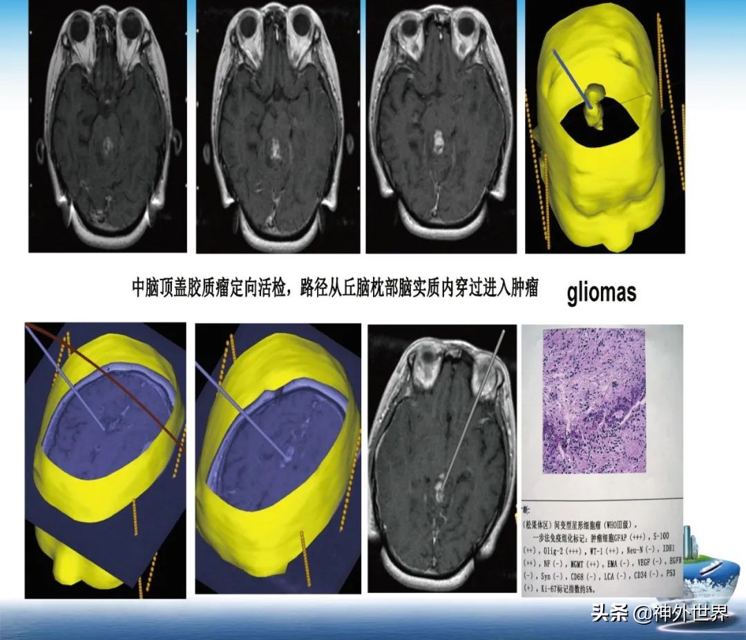 宣武医院神经外科王亚明祖籍,北京宣武医院神经科专家王亚明