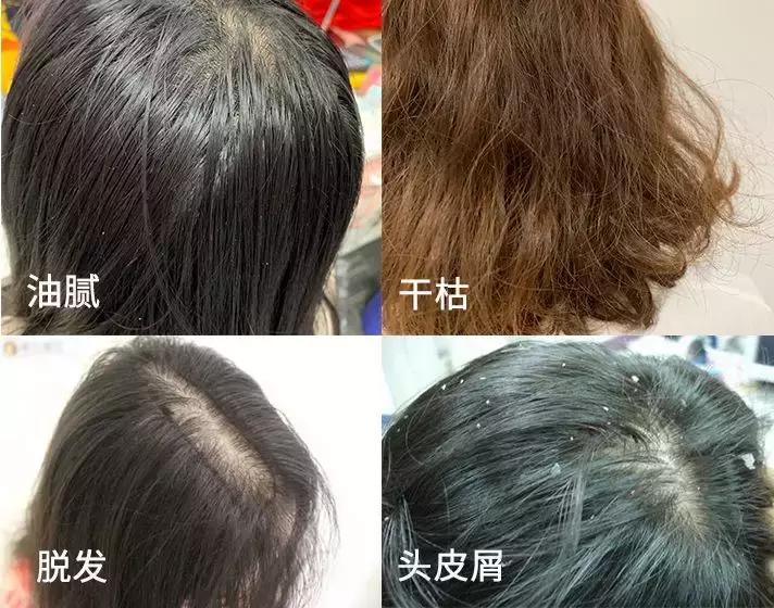 樱花头皮护理,樱花护发精油改善干枯防毛躁滋润