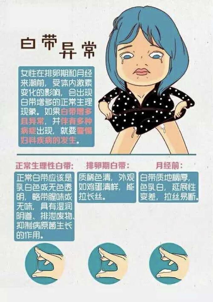 外阴瘙痒白带异常,白带异常吃什么药