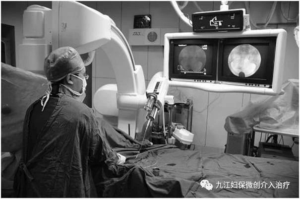 许润三治疗输卵管堵塞,输卵管伞端堵塞治疗方法