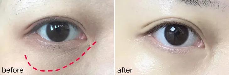 百年老牌马应龙又放大招，把眼纹收拾得服服帖帖，没有年龄感