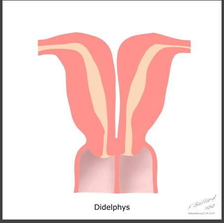 拥有双子宫的女人可以怀孕吗？会影响正常生活吗？