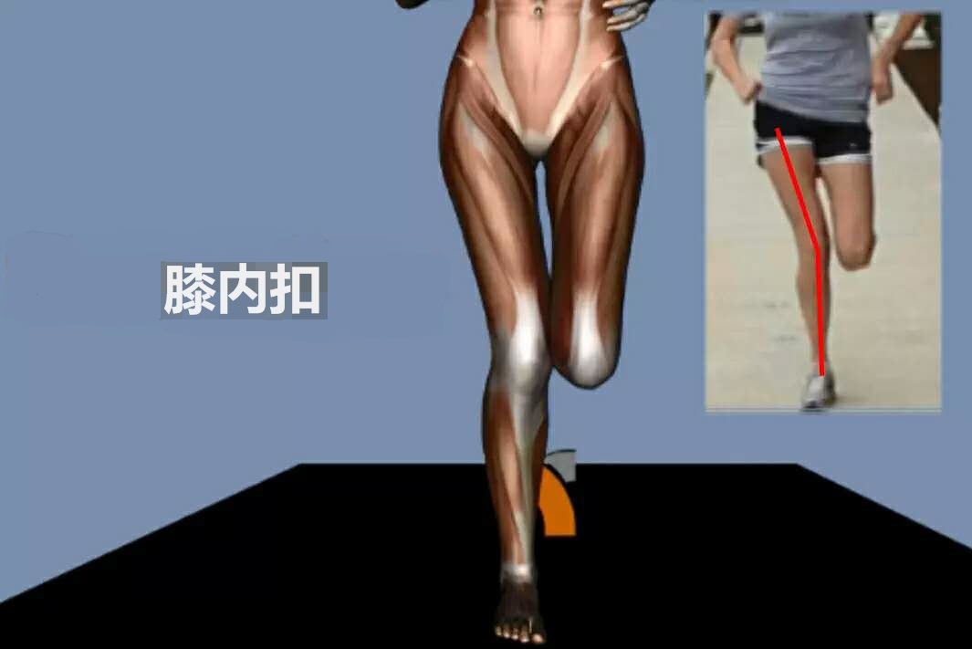 错误跑步姿势造成的危害,正确的跑步姿势远离跑步膝