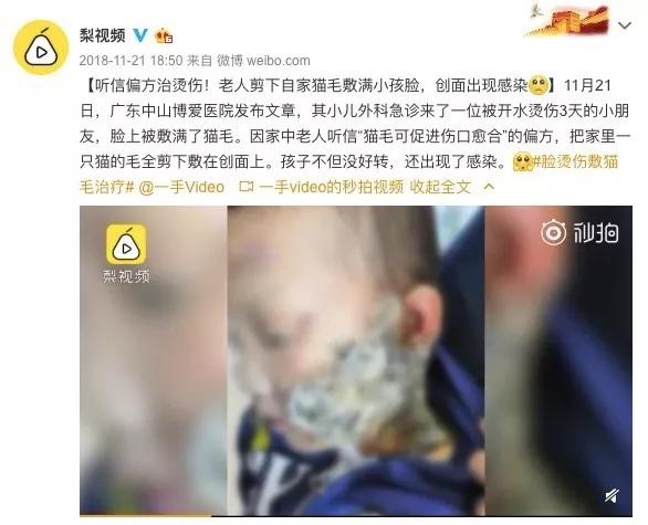 儿童烫伤急救五步法图片,儿童烫伤最佳处理时间只有2分钟