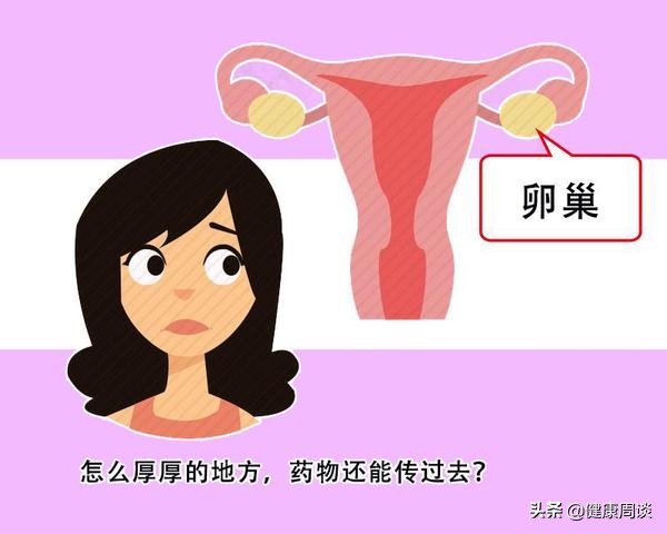 得了卵巢癌，身体上有一个征兆很“明显”，发现后，及时就医检查