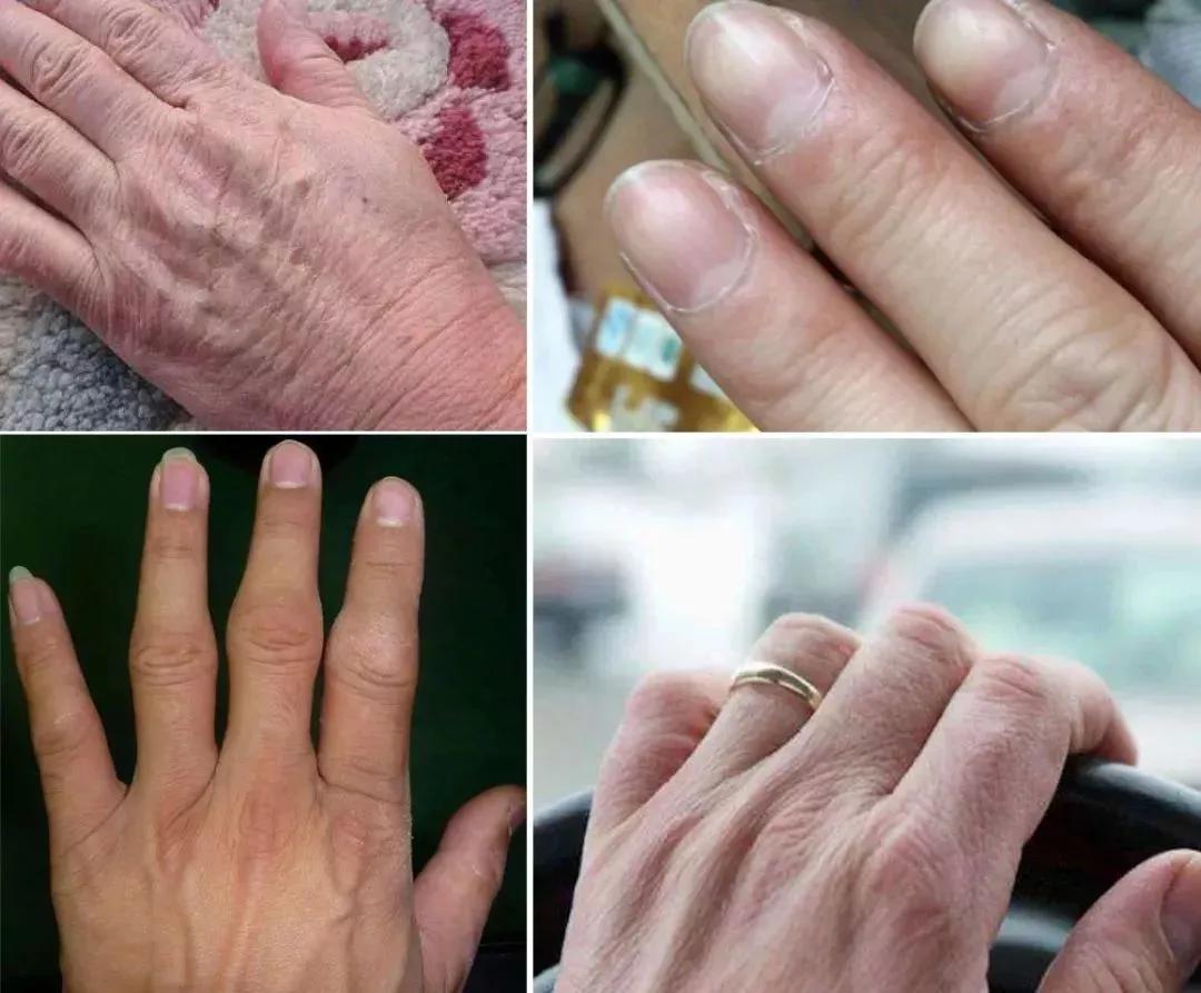 祛除角质细纹的护手霜,干裂护手霜秋冬季