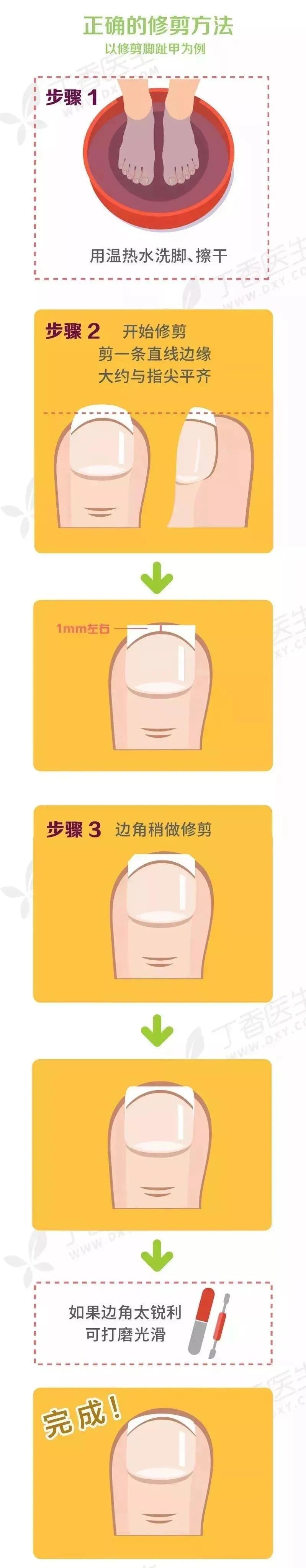 指甲长有什么不好,指甲长的有问题是怎么回事