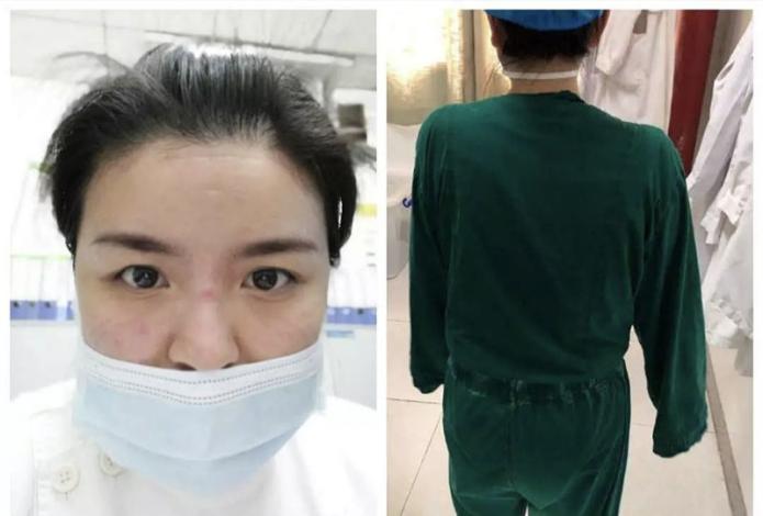 一线抗疫医护人员感染,抗疫一线医院医护人员