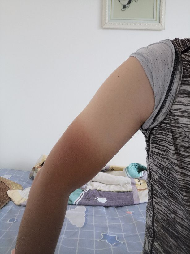 云南黑皮肤少年,云南黑皮肤