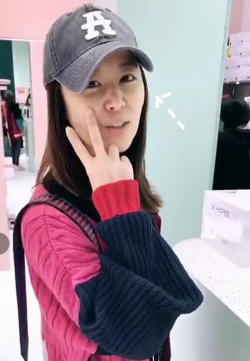 林心如法令纹怎么去掉的,林心如法令纹最新消息