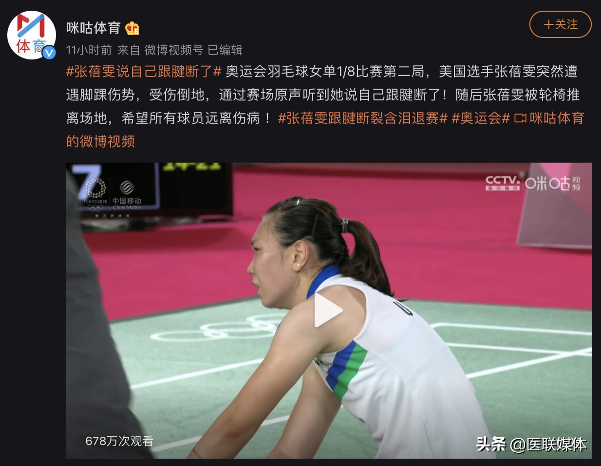 张蓓雯跟腱断裂治疗后期,张蓓雯跟腱断裂完整版