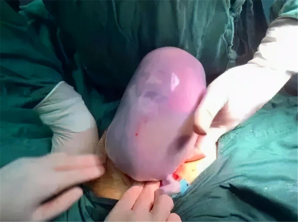 90后的宝妈怀孕死胎,90后宝妈生宝宝胖成猪