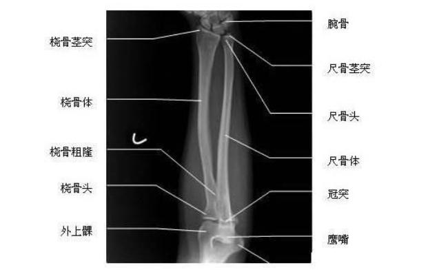 全身压痛点分布图,疼痛部位集中于颞下