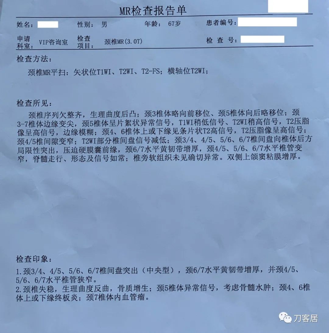 颈椎3-7节椎间盘突出需要微创治疗,颈椎4-7节椎间盘突出怎么治疗