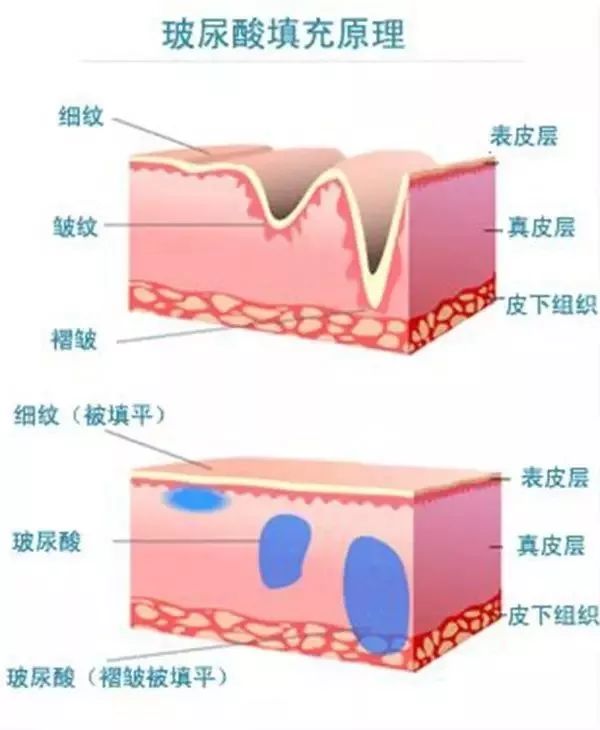 明明没动刀,为什么脸还是越来越精致?